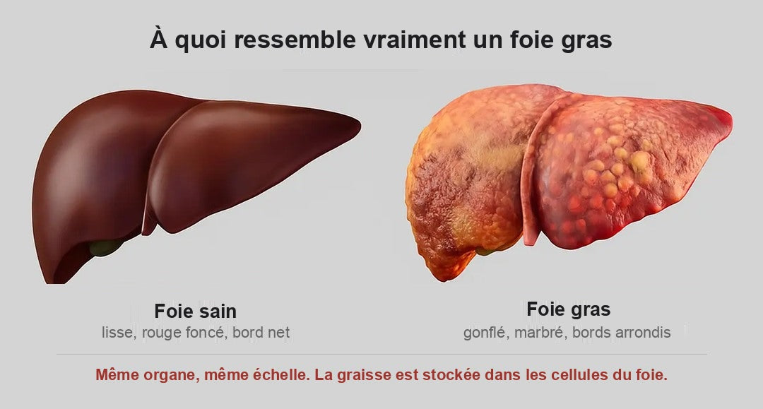 A healthy liver beside a fatty liver, side by side, same scale